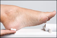 Seek Treatment for Dry, Cracked Heels