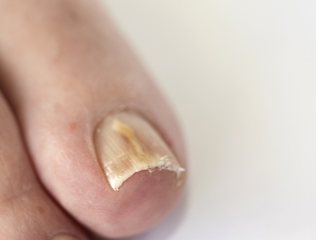 Before You Show Your Toes